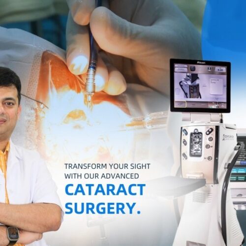 Varun Eye Care - Experience the Best Cataract Eye Surgery in Aligarh with Expert Surgeons