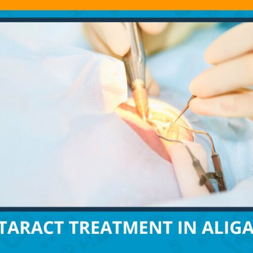 Varun Eye Care - Trusted Destination for Cataract Treatment in Aligarh