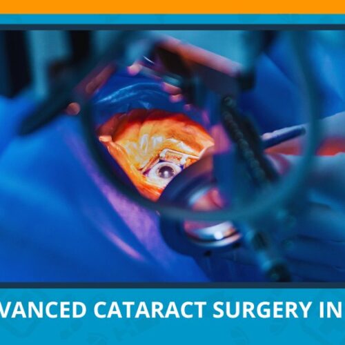 Varun Eye Care - Painless and Advanced Cataract Surgery in UP