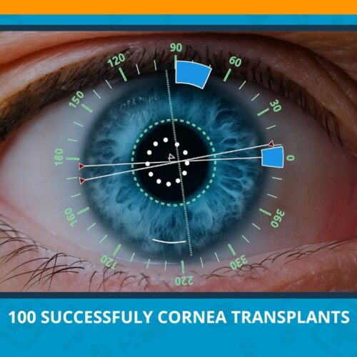 Varun Eye Care -Celebrating 100 Successful Cornea Transplants